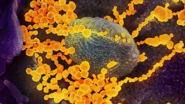 Imagen microscópica del coronavirus / EFE