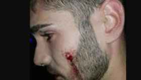 Una imagen del joven herido tras la agresión homófoba por parte de uno de los porteros de la discoteca