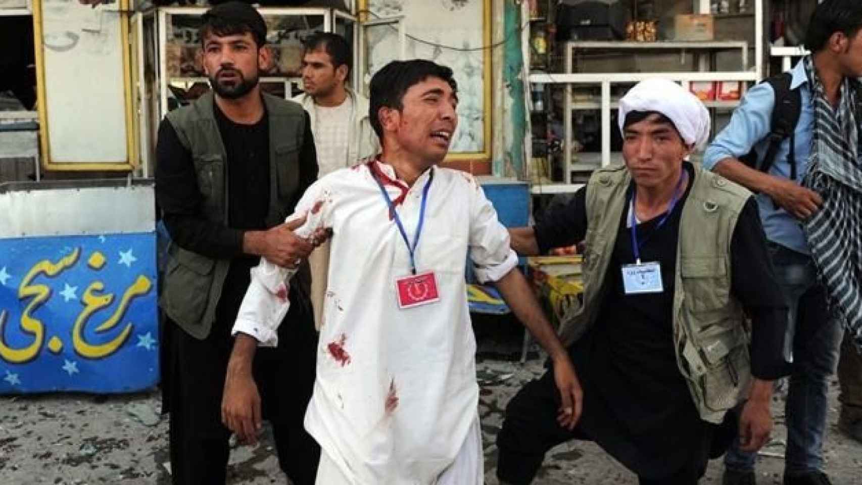 Una de las victimas durante el atentado de este sábado en Kabul en el que hay al menos 80 fallecidos.