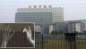 El Hospital de Ruihua (China) en el que han intervenido al niño de 11 años que se ha amputado un dedo, tal y como se muestra en la radiografía.