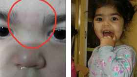 Una foto de archivo de una de las menores antes y después de ser depilada en el entrecejo en la guardería