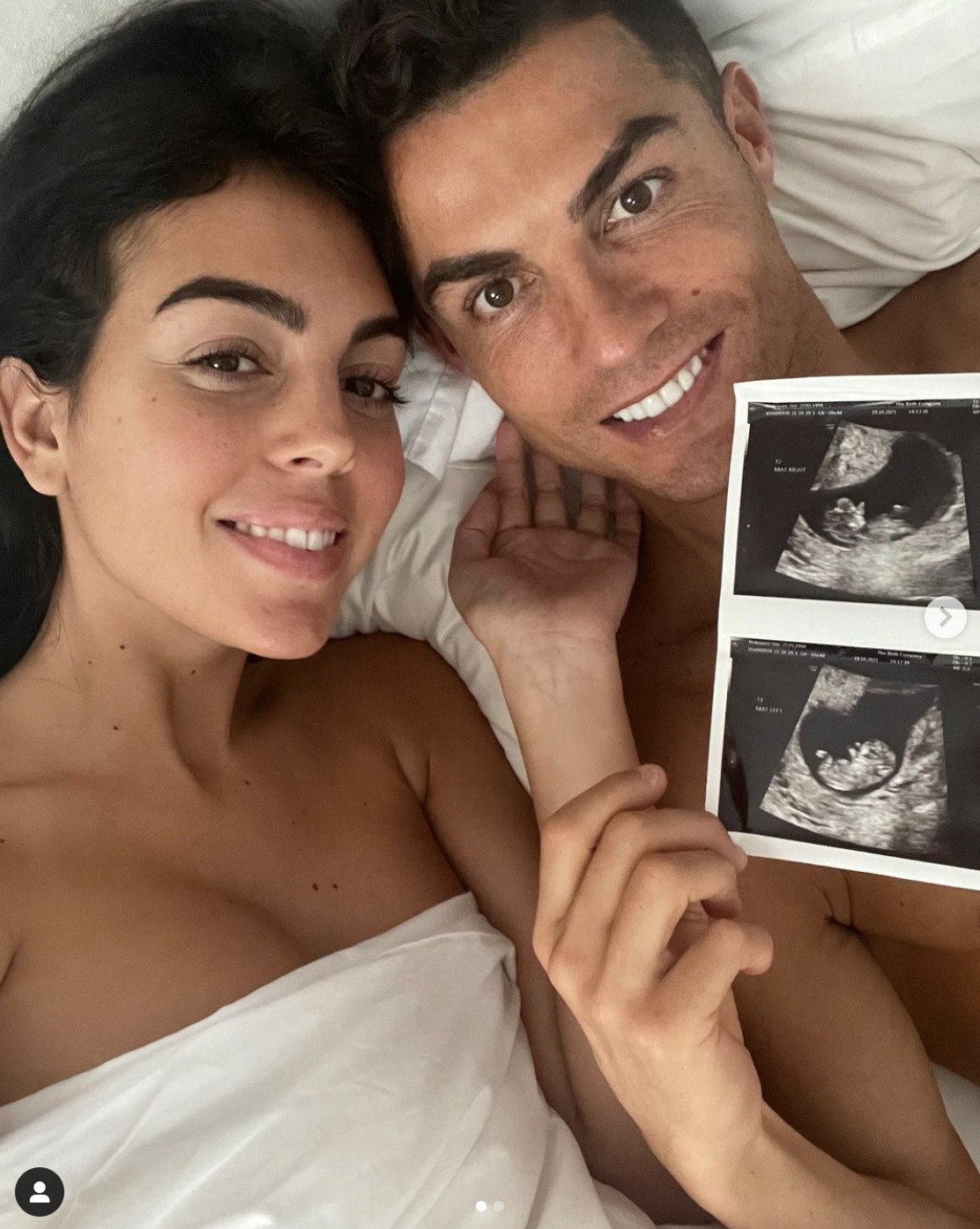 Georgina Rodríguez y Cristiano Ronaldo, embarazados de gemelos
