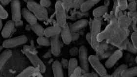 Bacterias del género de la listeria en una imagen microscópica / EP