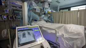 Un hombre con coronavirus se recupera en una uci bajo la mirada de dos enfermeros / EP