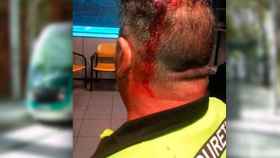 Heridas causadas al vigilantes de seguridad con el TRAMBesòs de fondo / CG