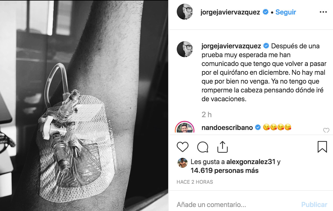 Jorge Javier Vázquez anuncia que tendrá que volver a operarse debido al ictus que sufrió / INSTAGRAM