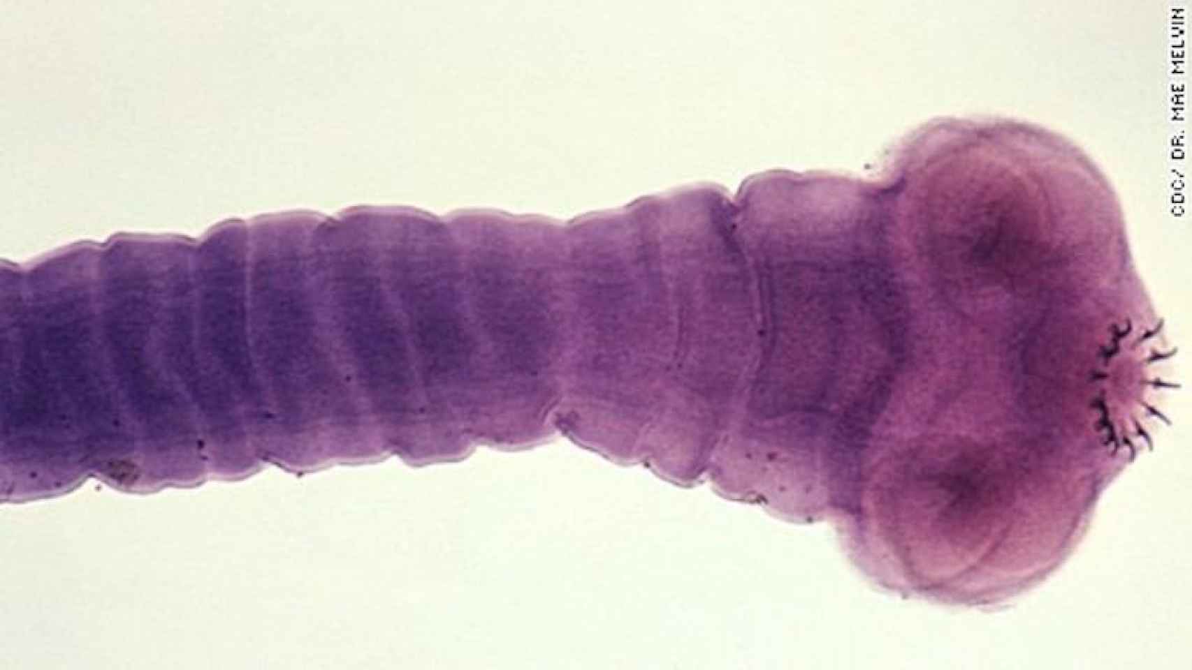 Una foto ilustrativa de una larva