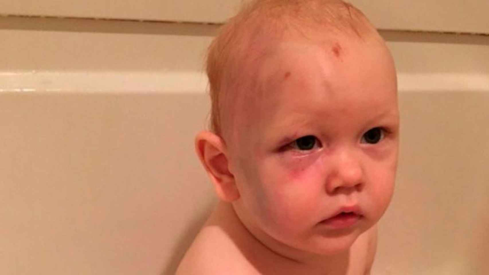 El bebé fue golpeado por la niñera según sus padres / Facebook