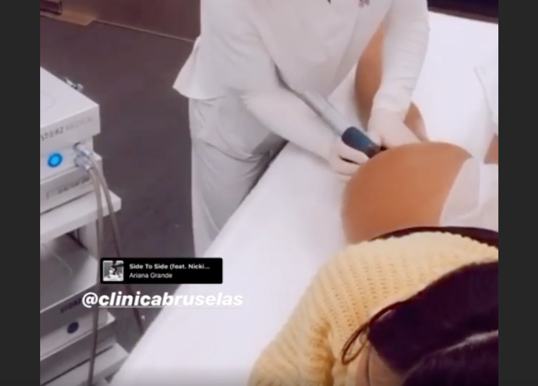 Chabelita retransmite en directo a través de sus redes sociales su operación de nalgas / INSTAGRAM