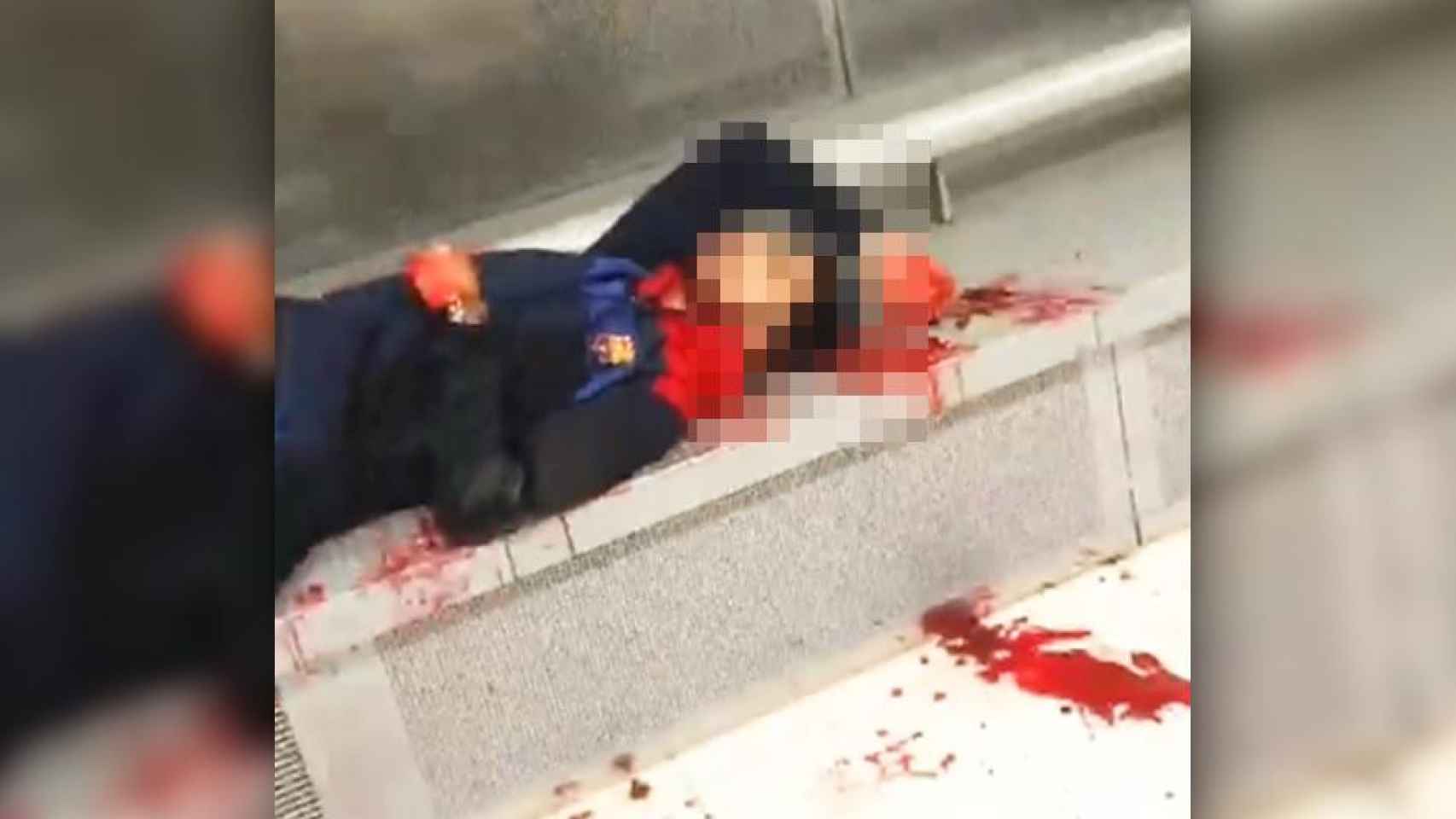 Imagen de uno de los heridos en la pelea en Badalona en la estación de La Salut del Metro de Barcelona / CG