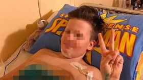 Arkady Aksenov, de 11 años, perdió las piernas en un juego al que le retaron sus amigos