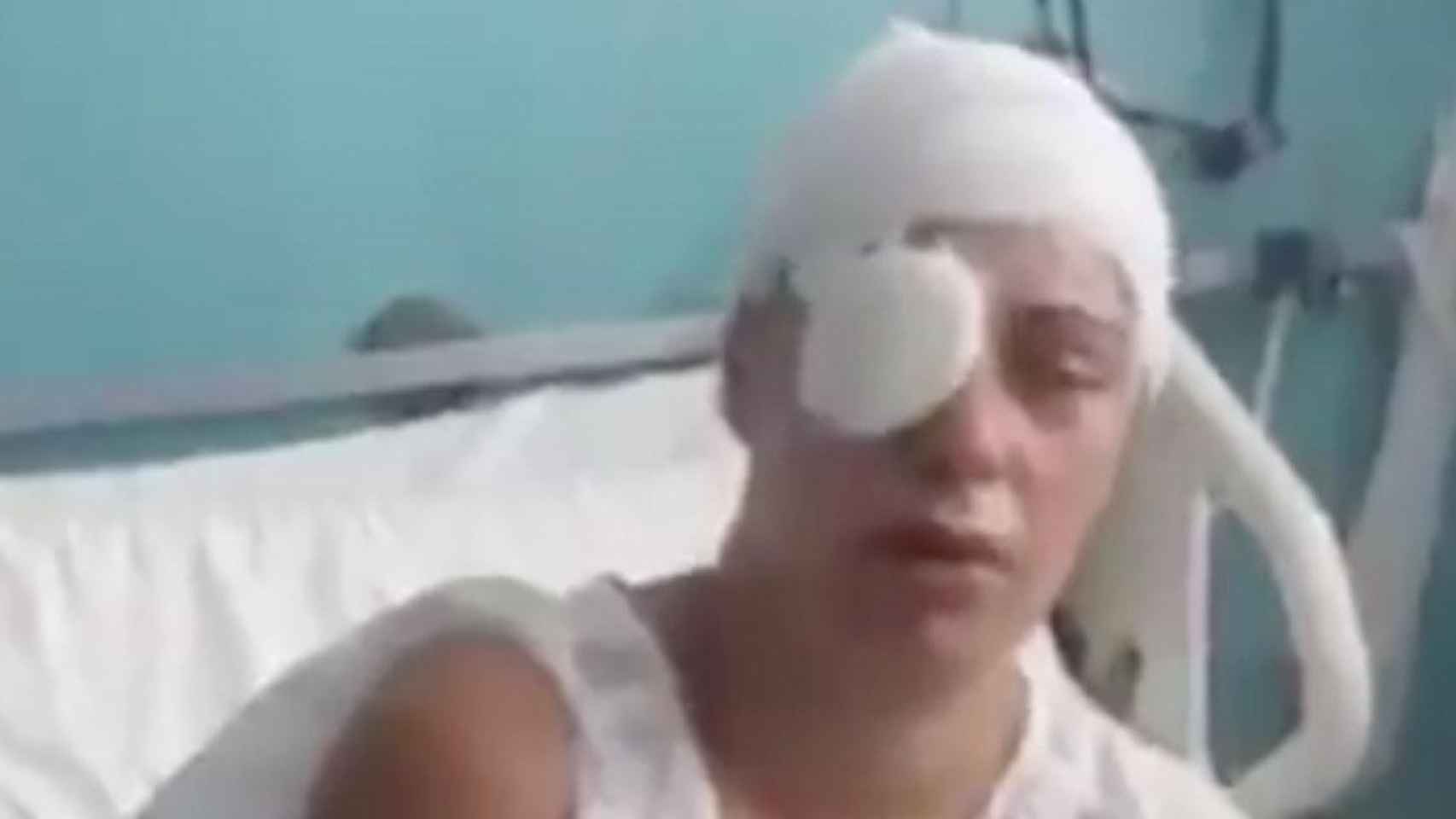 Ana Mari, la mujer de 35 años agredida con ácido en Sant Feliu, en el Vall d'Hebron