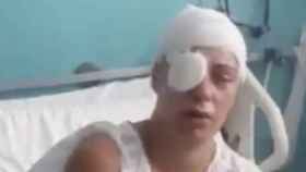 Ana Mari, la mujer de 35 años agredida con ácido en Sant Feliu, en el Vall d'Hebron
