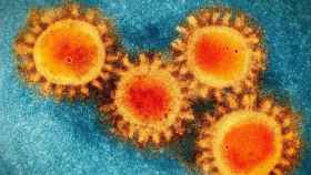 Foto de microscopio electrónico del coronavirus Covid-19 / SCRIPPS RESEARCH INSTITUTE (EUROPA PRESS)