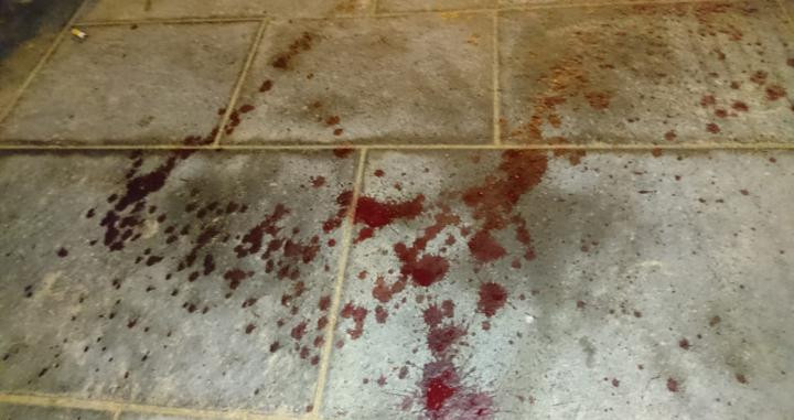Sangre del turista agredido el martes en Barcelona tras un intento de robo con violencia / CG