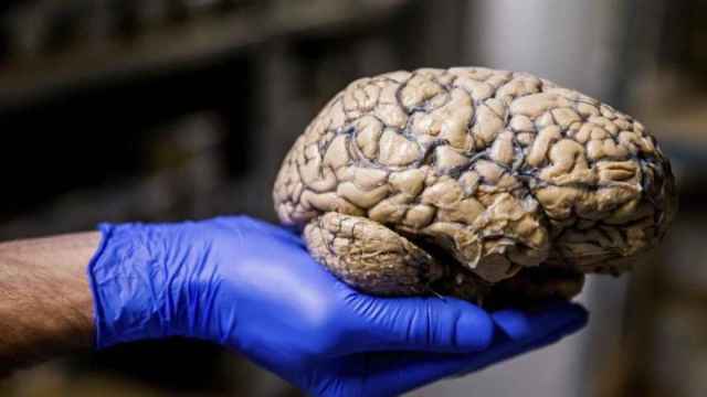Un cerebro humano / EFE
