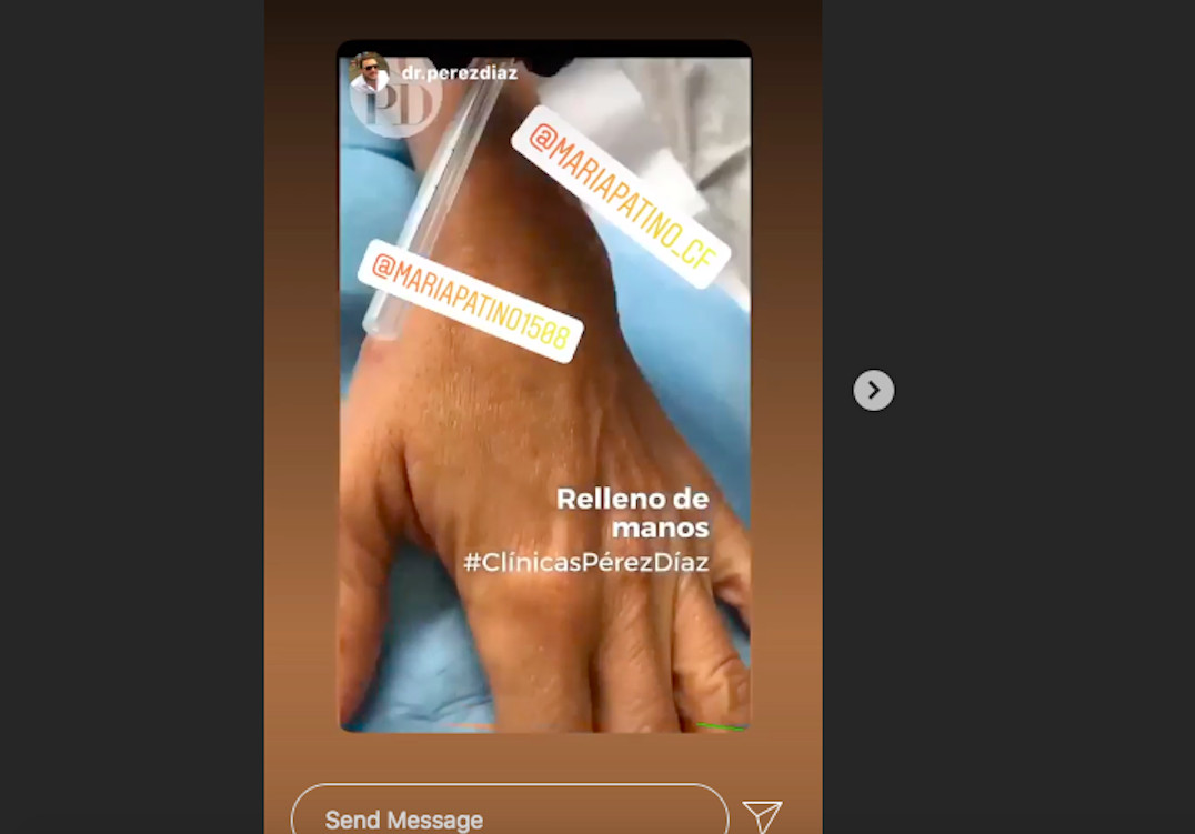 María Patiño desvela que se ha operado las manos para quitarse las arrugas / INSTAGRAM