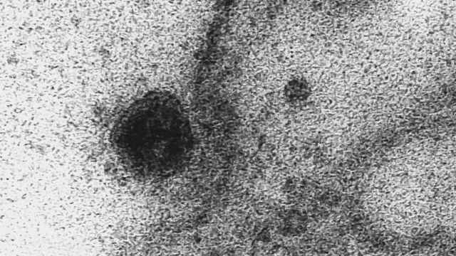 Imagen microscópica del coronavirus SARS-CoV-2 infectando una célula / EFE