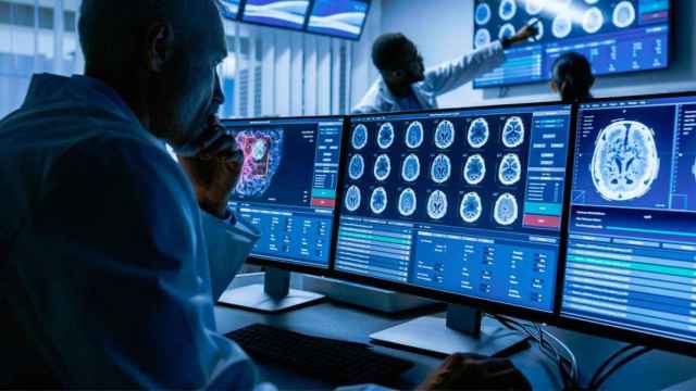 Un médico revisa imágenes de un cerebro con Alzheimer / RTVE