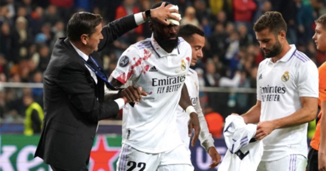 Antonio Rüdiger, saliendo ensangrentando del Shakhtar-Real Madrid / REDES