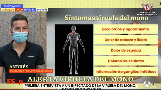Andrés, paciente contagiado de viruela del mono /ANTENA 3