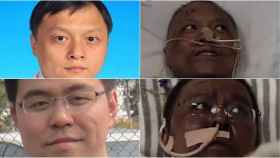 El doctor Hu (arriba) murió tras volverse negro con Covid 19, el doctor Yi (abajo), con la misma afectación, pudo superar la enfermedad / HOSPITAL CENTRAL DE WUHAN