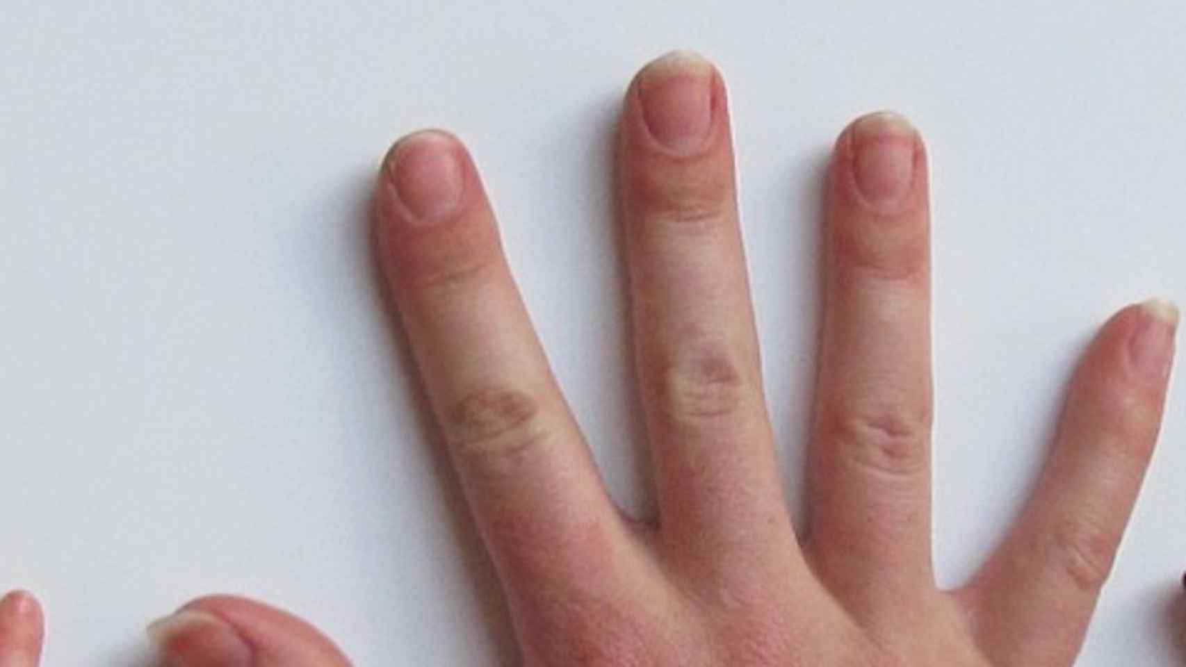Una foto de archivo de una mano uñas