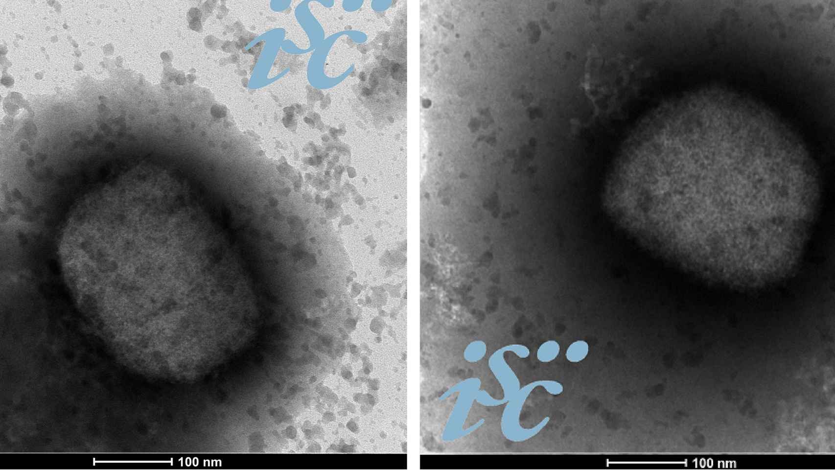 Dos imágenes, obtenidas por microscopía electrónica, del virus de la viruela del mono / Unidad de Microscopía Electrónica del ISCIII