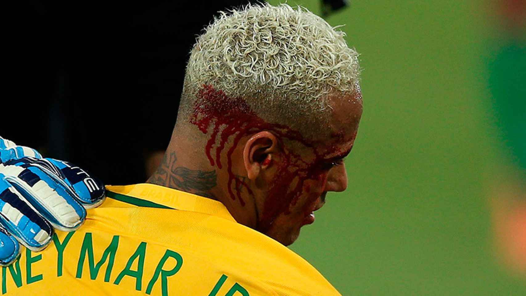 Neymar, herido durante el partido de Brasil ante Bolivia, el 6 de octubre de 2016 | EFE