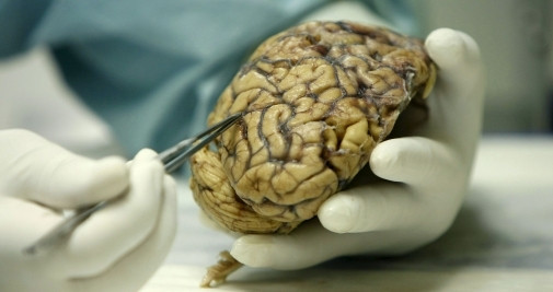 Un médico realiza un ensayo clínico con un cerebro / EFE