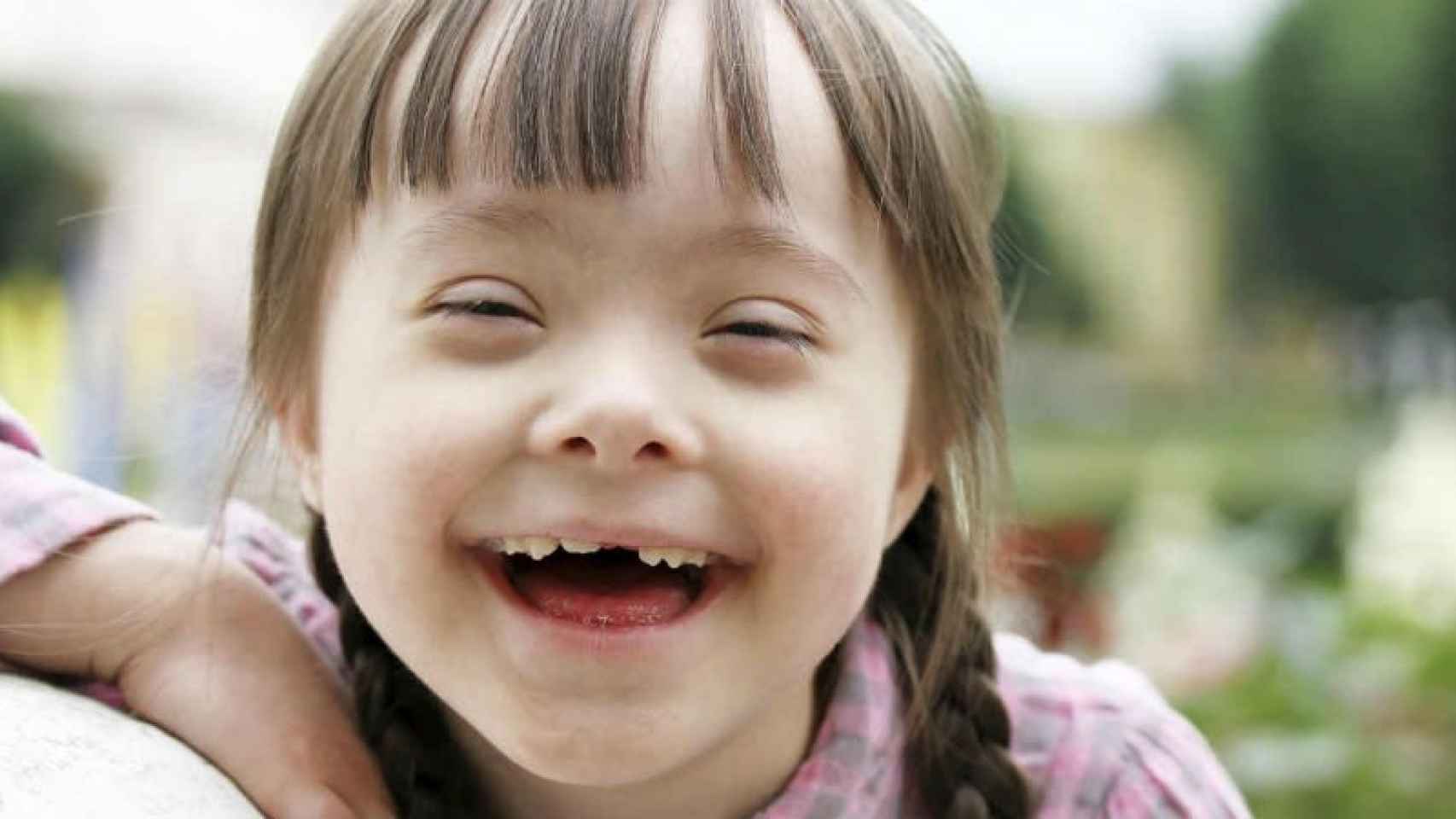 Una niña con síndrome de Down.