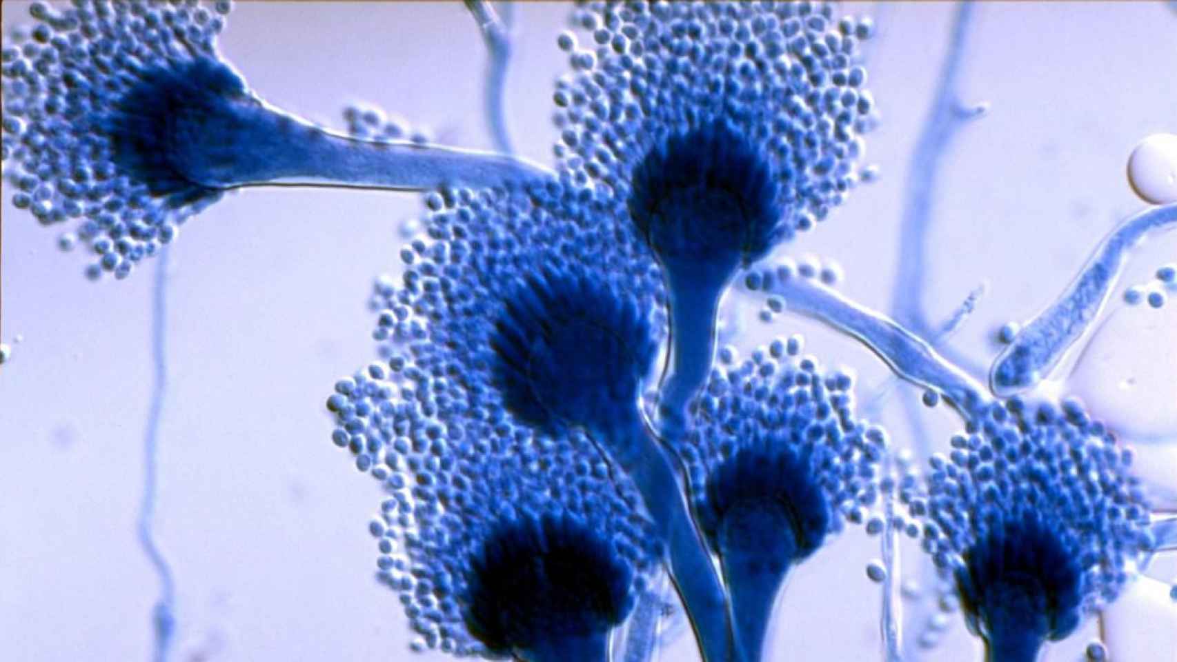 Imagen del hongo aspergyllus, que provoca aspergilosis