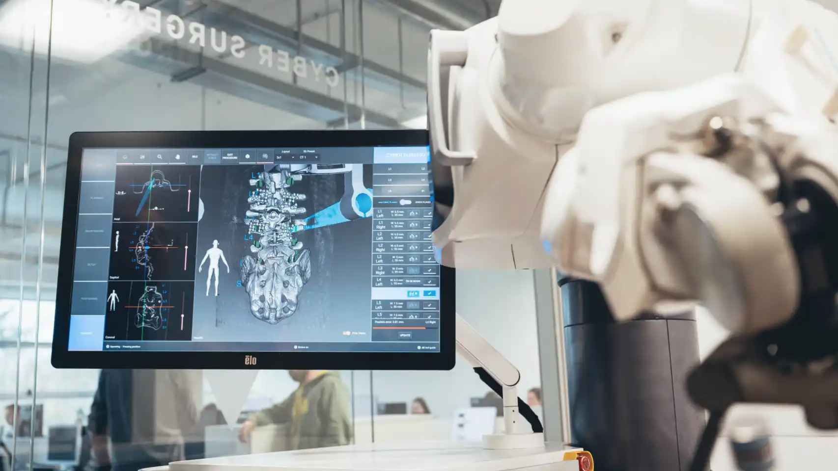 Un robot quirúrgico para operaciones de columna
