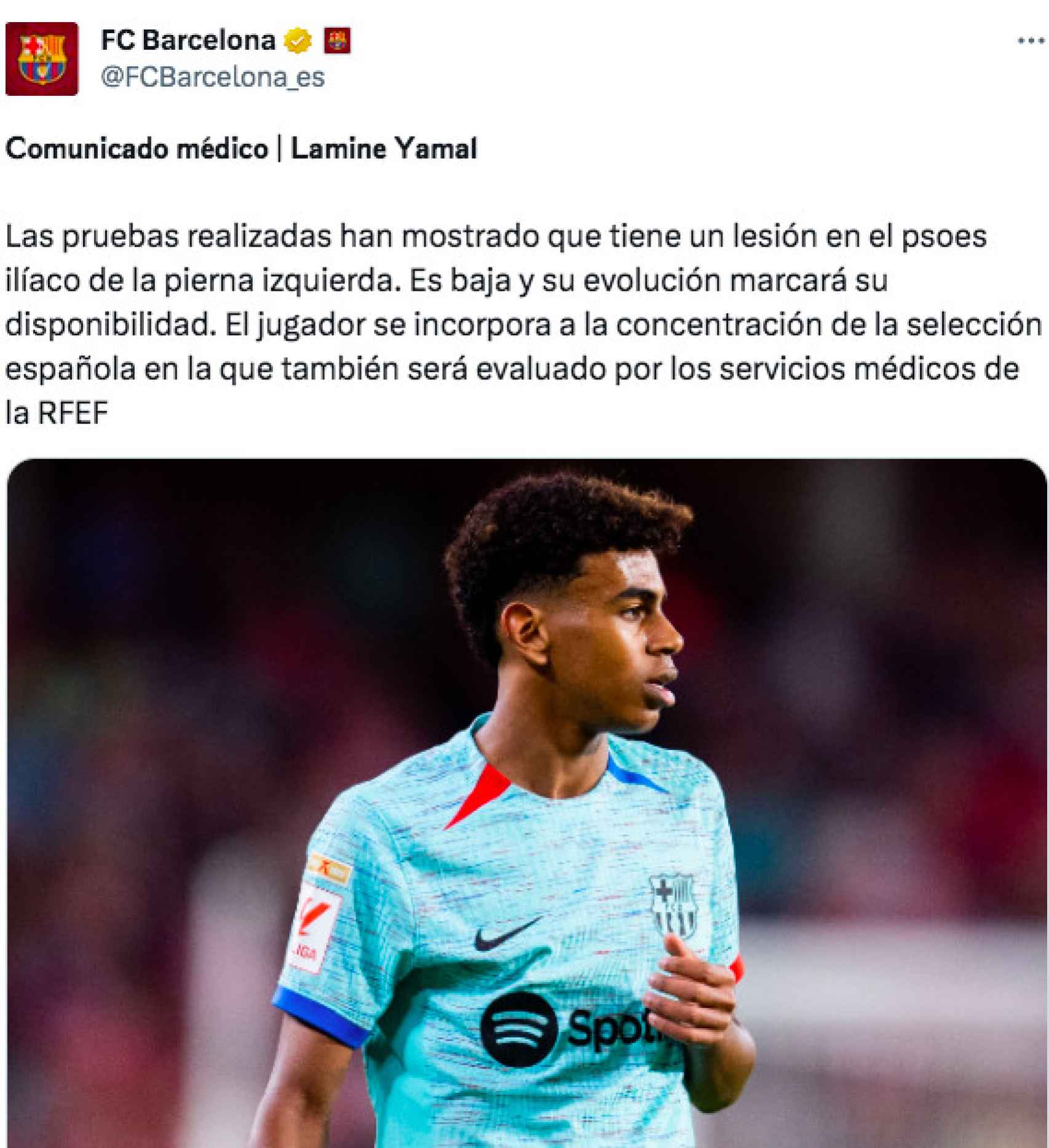 Comunicado del Barça sobre la lesión de Lamine Yamal