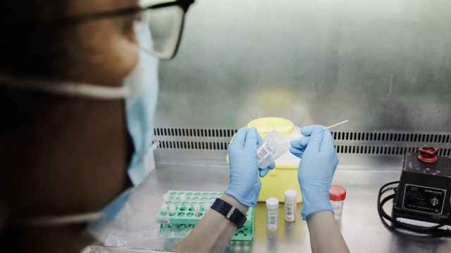 Una tcnico de laboratorio sostiene una de las pruebas de anlisis para la viruela del mono / Carlos Lujn-EP
