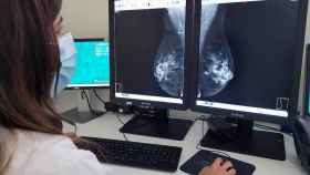 Mamografa para detectar cncer de mama / EP