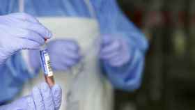 Un sanitario sostiene un muestra para realizar un Anlisis PCR e / H.Bilbao - Europa Press