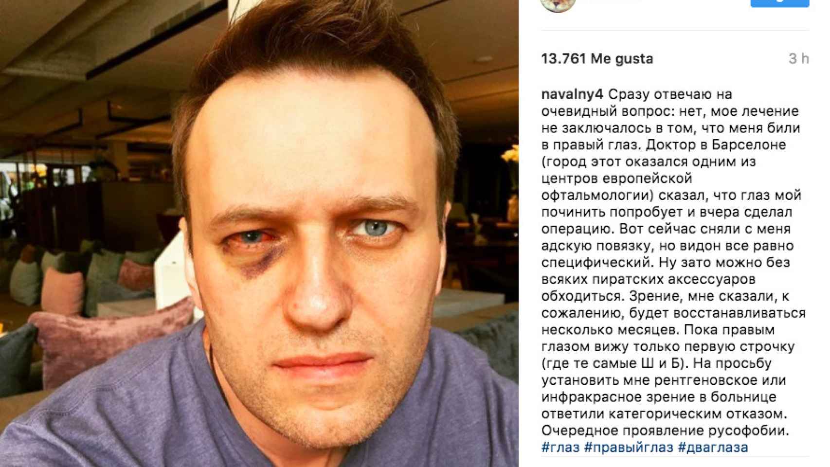 La entrada de Instagram del líder opositor ruso Alexéi Navalni / INSTAGRAM
