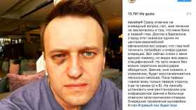 La entrada de Instagram del líder opositor ruso Alexéi Navalni / INSTAGRAM