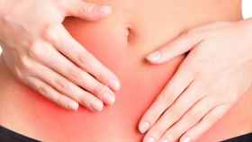 La endometriosis afecta al 10 % de las mujeres en edad fértil / HUD