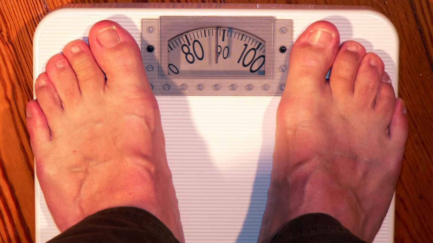 Los problemas psicológicos asociados a la obesidad y el sobrepeso pueden acentuarse en verano