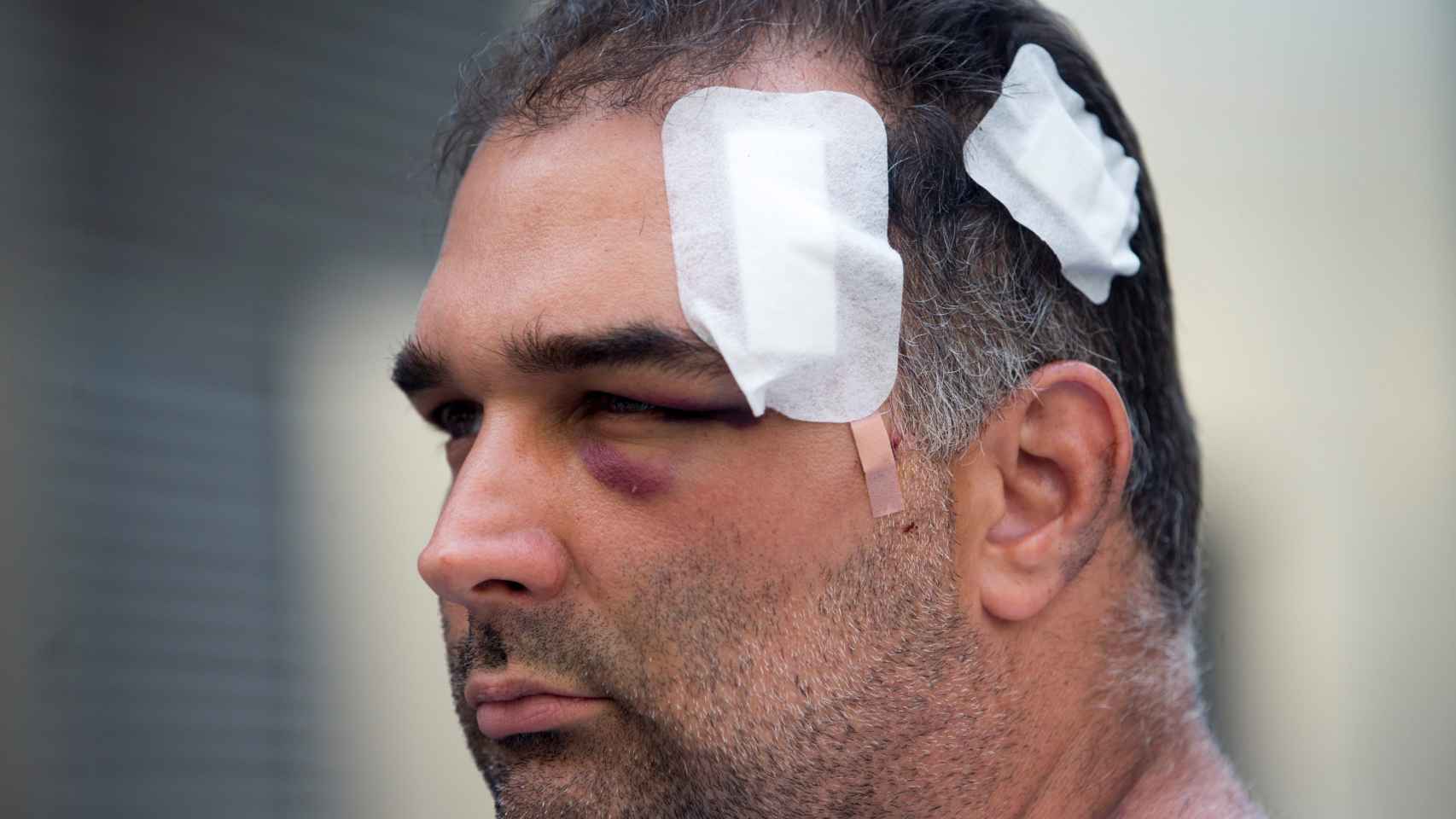 José Bravo, el turista agredido por los manteros en Barcelona / EFE QUIQUE GARCÍA