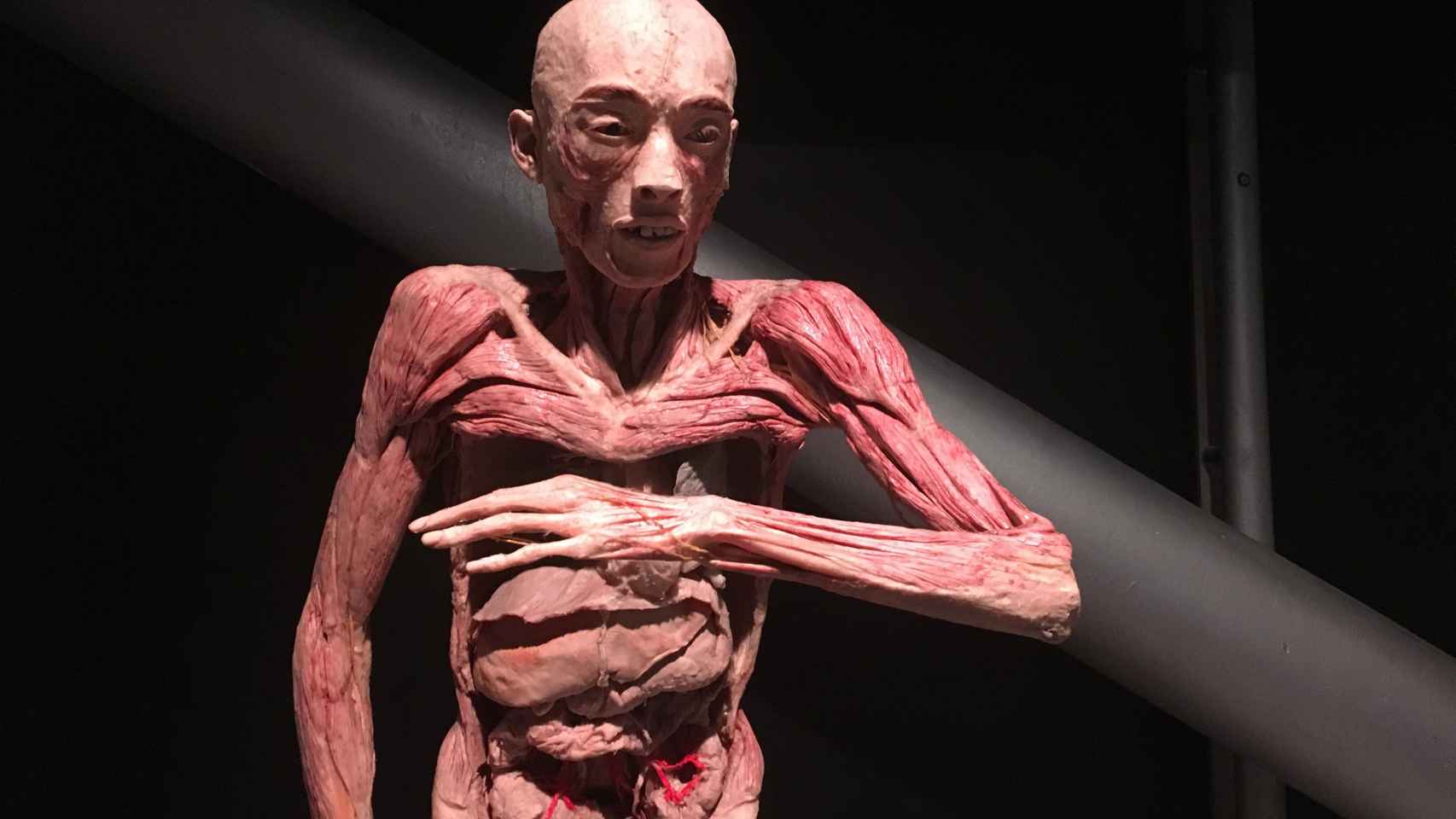Uno de los cuerpos incluidos en el exposición 'Human Bodies' | PAULA BALDRICH