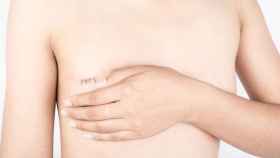 Conservar el pezón es inviable en muchas mastectomías por cáncer de mama / FUNDACIÓN