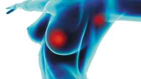 Una técnica para la localización y extirpación de tumores de mama / Archivo