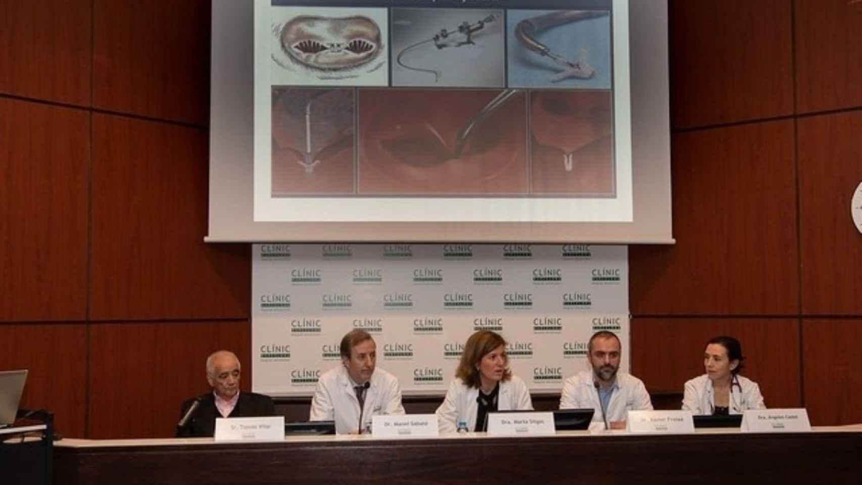 Conferencia en el Hospital Clínic sobre las operaciones de prótesis cardíaca MitraClip / EUROPA PRESS