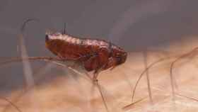 Una pulga picando a un ser humano / PIXABAY