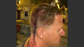 Imagen de la víctima golpeada con extrema violencia tras un robo en la Barceloneta / HELPERS