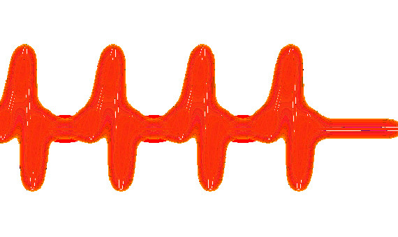 Imagen de un electreocardiograma