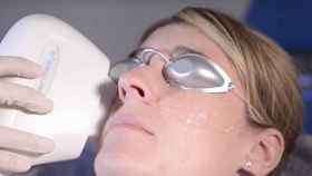 Muestra de la terapia Thermaeye contra el síndrome del ojo seco